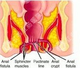 肛门疼痛