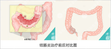 福州肛肠医院