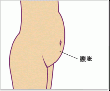 腹胀百科