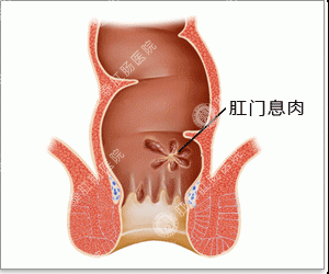 福州肛肠医院