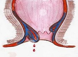 福州肛肠医院